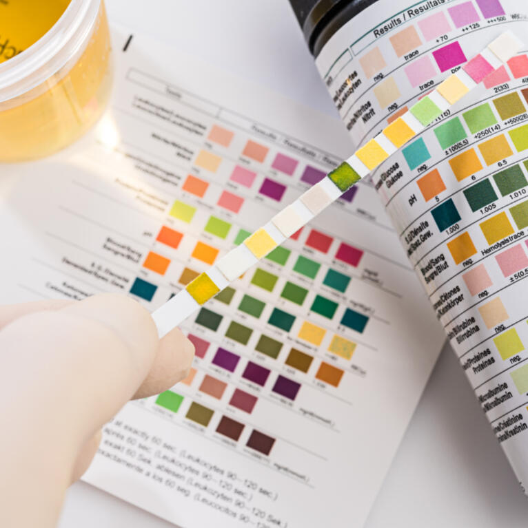 UTI strip test